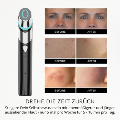 SkinGlow I 6-in-1-Gesichtsbehandlung
